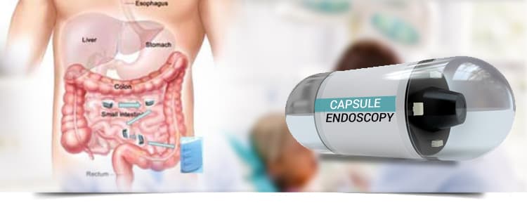 Healthcare market analysis — Global Capsule Endoscopy Market to Reach US$ 0.87 Billion by 2033 as AI-Driven "Pill-Sized" Imaging Redefines Non-Invasive GI Diagnostics
